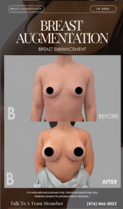 Breast Lift vs. Breast Implants